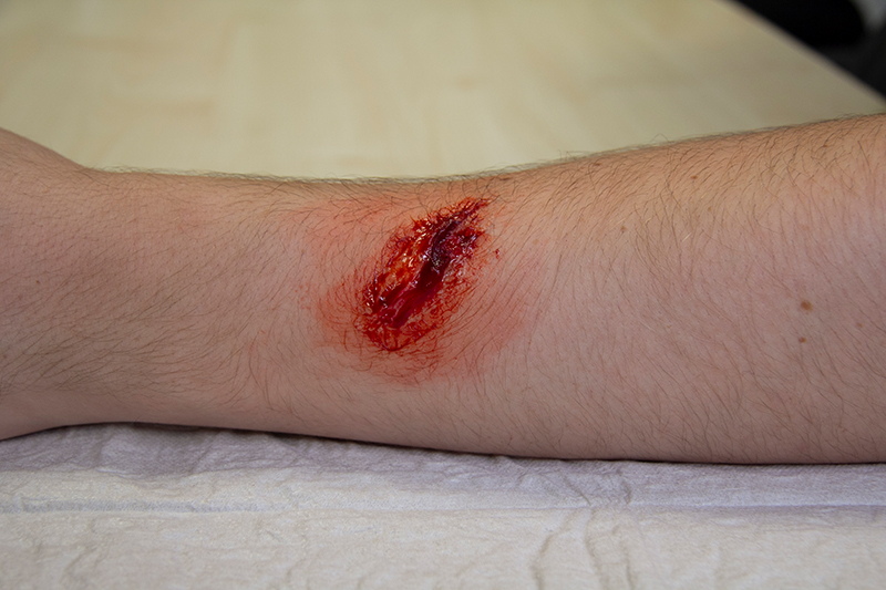 EZ WOUNDS – WUNDENSIMULATION FÜR SIMULATIONSPATIENTEN EZ WOUNDS – WUNDENSIMULATION FÜR SIMULATIONSPATIENTEN