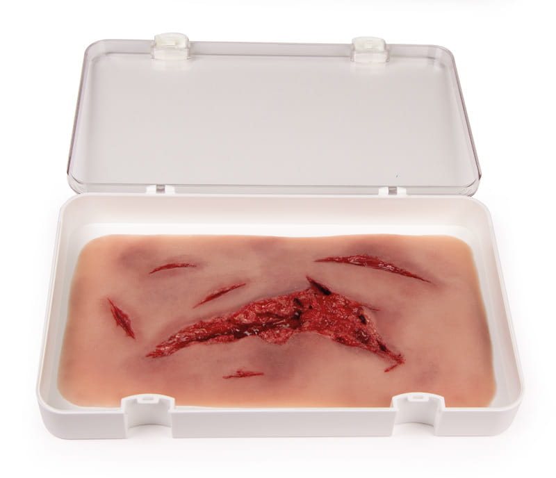 RISSWUNDE GROSS MIT BLUTUNGSFUNKTION RISSWUNDE GROSS MIT BLUTUNGSFUNKTION