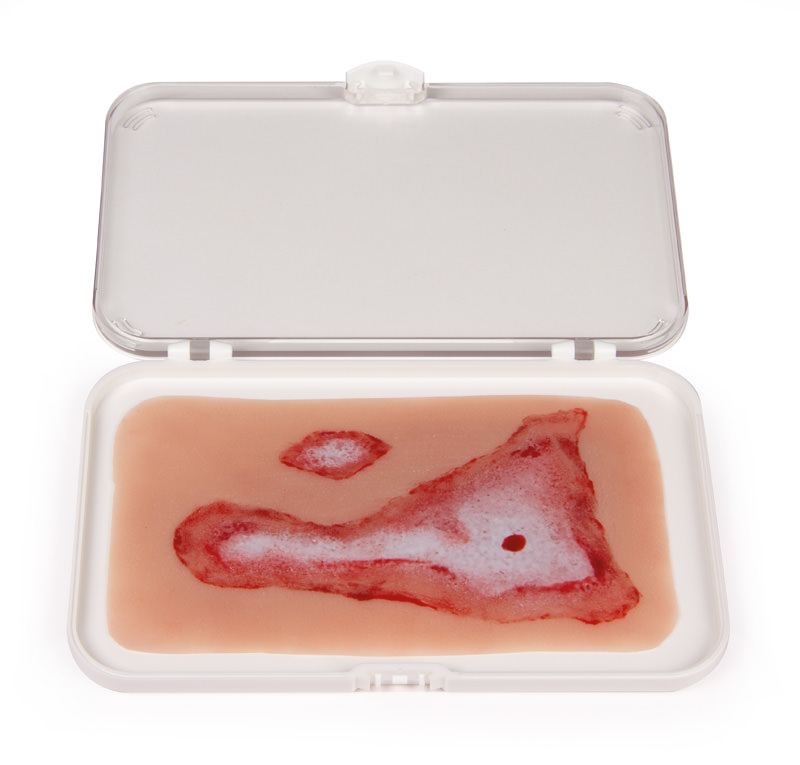 WUNDMOULAGE VERBRÜHUNG Selbsthaftend WUNDMOULAGE VERBRÜHUNG Selbsthaftend