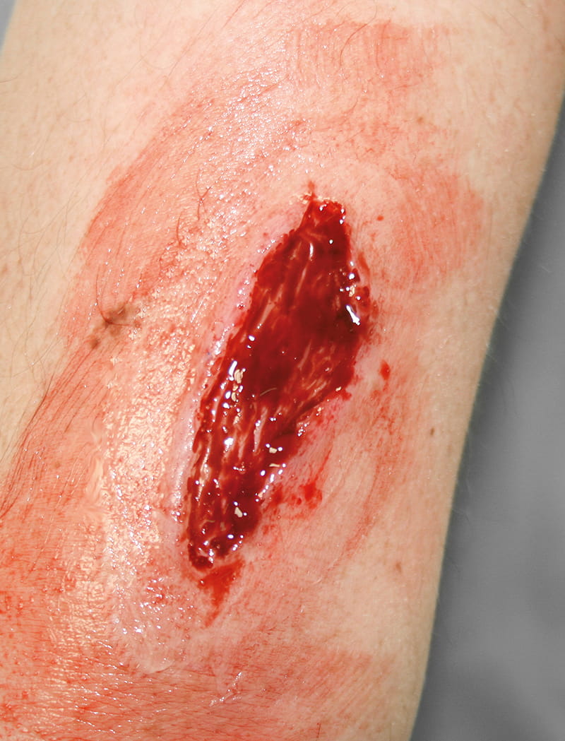 EZ WOUNDS WUNDENSIMULATIONSSET „PROFESSIONAL“ EZ WOUNDS WUNDENSIMULATIONSSET „PROFESSIONAL“