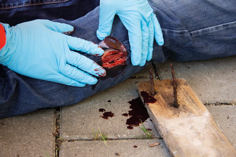 WUNDMOULAGE SCHNITTWUNDE WUNDMOULAGE SCHNITTWUNDE
