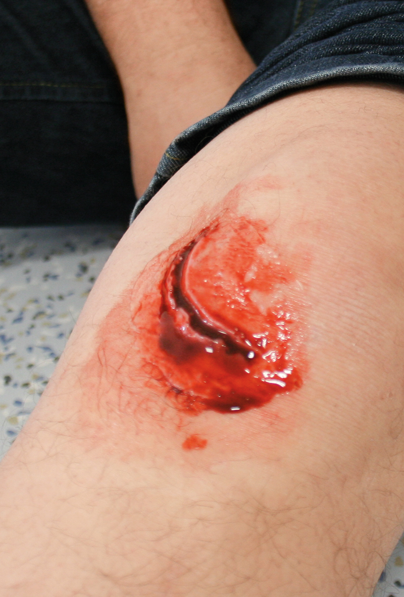 EZ WOUNDS WUNDENSIMULATIONSSET „PROFESSIONAL“ EZ WOUNDS WUNDENSIMULATIONSSET „PROFESSIONAL“
