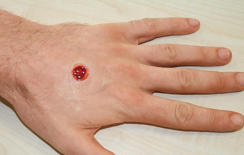 EZ WOUNDS WUNDENSIMULATIONSSET „PROFESSIONAL“ EZ WOUNDS WUNDENSIMULATIONSSET „PROFESSIONAL“