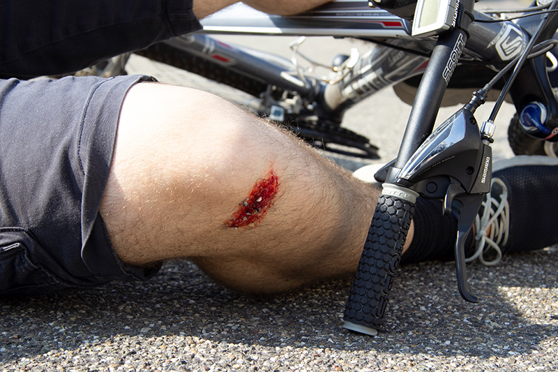 EZ WOUNDS – WUNDENSIMULATION FÜR SIMULATIONSPATIENTEN EZ WOUNDS – WUNDENSIMULATION FÜR SIMULATIONSPATIENTEN