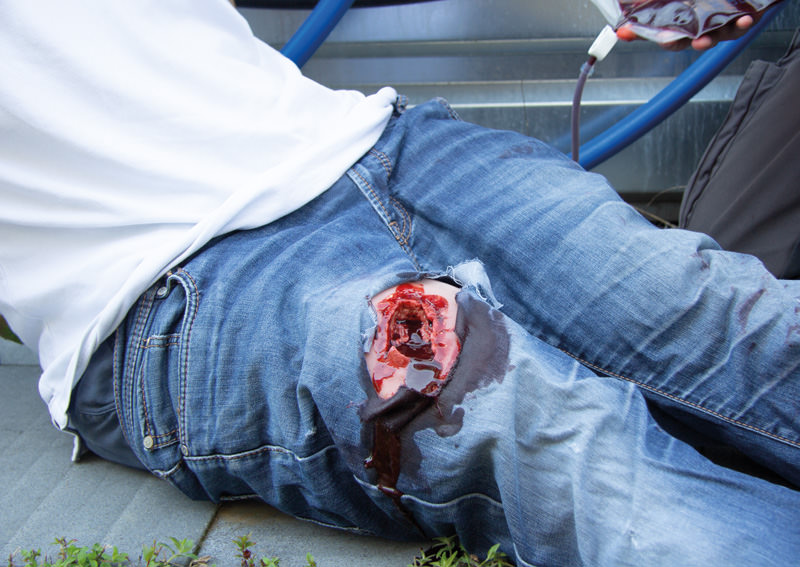 WUNDMOULAGE WOUND PACKING WUNDMOULAGE WOUND PACKING