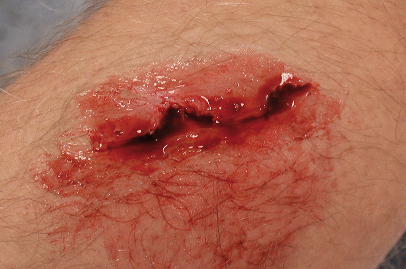 EZ WOUNDS WUNDENSIMULATIONSSET „PROFESSIONAL“ EZ WOUNDS WUNDENSIMULATIONSSET „PROFESSIONAL“