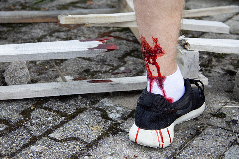 EZ WOUNDS – WUNDENSIMULATION FÜR SIMULATIONSPATIENTEN EZ WOUNDS – WUNDENSIMULATION FÜR SIMULATIONSPATIENTEN