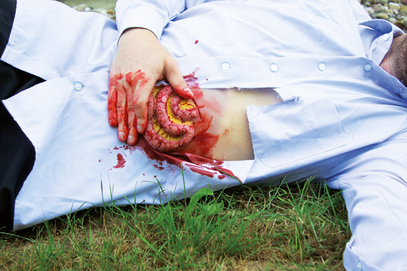 WUNDMOULAGE DÜNNDARMAUSTRITT WUNDMOULAGE DÜNNDARMAUSTRITT