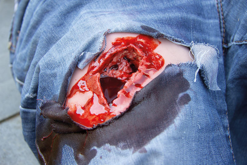 WUNDMOULAGE WOUND PACKING WUNDMOULAGE WOUND PACKING