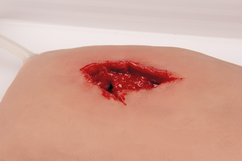 WUNDMOULAGE WOUND PACKING WUNDMOULAGE WOUND PACKING