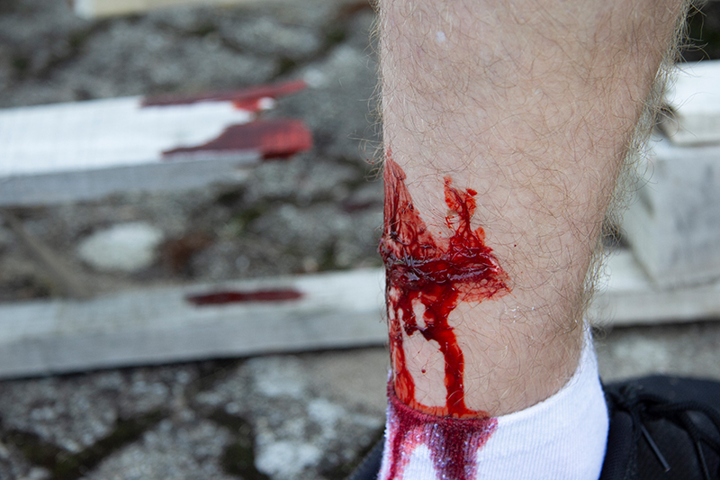 EZ WOUNDS – WUNDENSIMULATION FÜR SIMULATIONSPATIENTEN EZ WOUNDS – WUNDENSIMULATION FÜR SIMULATIONSPATIENTEN