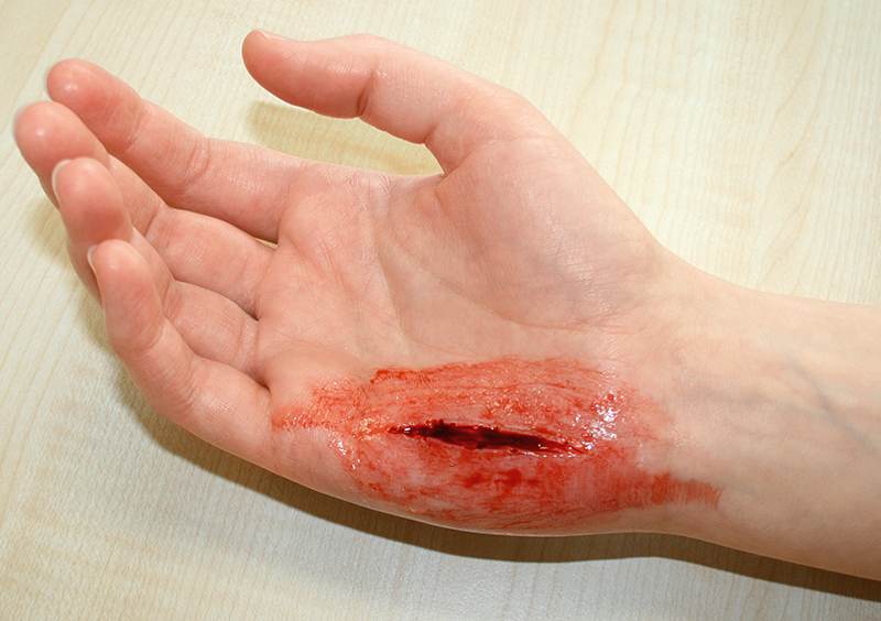 EZ WOUNDS WUNDENSIMULATIONSSET „PROFESSIONAL“ EZ WOUNDS WUNDENSIMULATIONSSET „PROFESSIONAL“