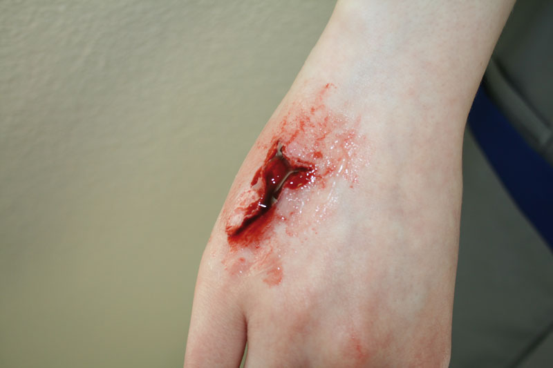 EZ WOUNDS – WUNDENSIMULATION FÜR SIMULATIONSPATIENTEN EZ WOUNDS – WUNDENSIMULATION FÜR SIMULATIONSPATIENTEN