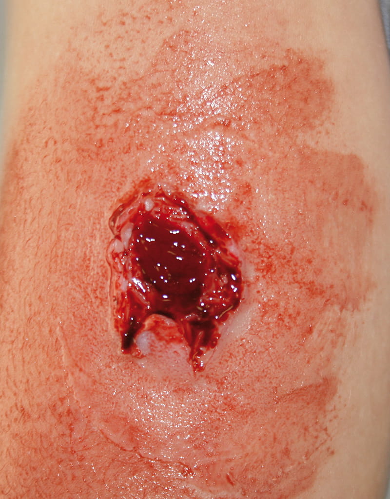 EZ WOUNDS WUNDENSIMULATIONSSET „PROFESSIONAL“ EZ WOUNDS WUNDENSIMULATIONSSET „PROFESSIONAL“