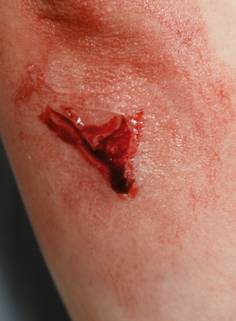 EZ WOUNDS WUNDENSIMULATIONSSET „PROFESSIONAL“ EZ WOUNDS WUNDENSIMULATIONSSET „PROFESSIONAL“