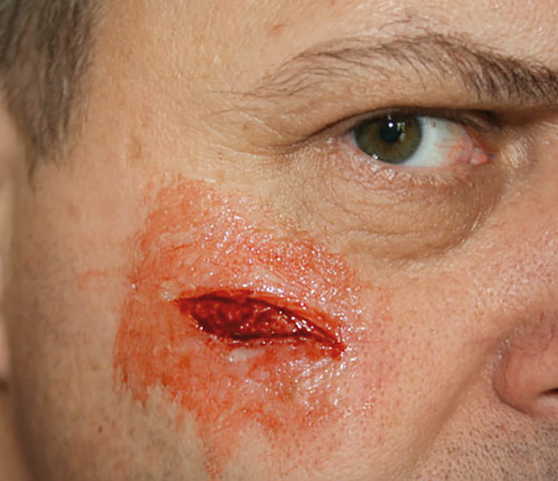 EZ WOUNDS WUNDENSIMULATIONSSET „PROFESSIONAL“ EZ WOUNDS WUNDENSIMULATIONSSET „PROFESSIONAL“