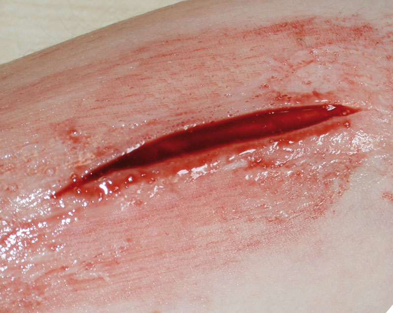 EZ WOUNDS – WUNDENSIMULATION FÜR SIMULATIONSPATIENTEN EZ WOUNDS – WUNDENSIMULATION FÜR SIMULATIONSPATIENTEN
