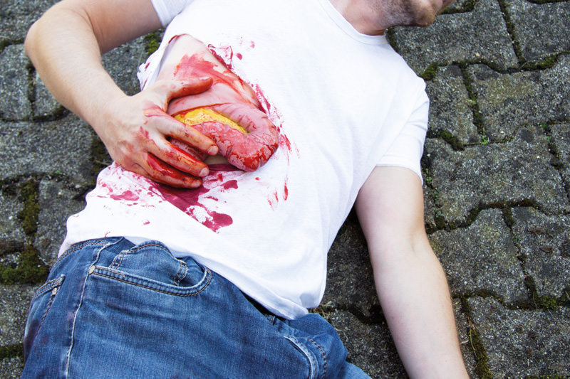 WUNDMOULAGE DICKDARMAUSTRITT WUNDMOULAGE DICKDARMAUSTRITT