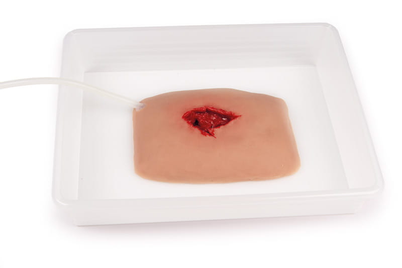 WUNDMOULAGE WOUND PACKING WUNDMOULAGE WOUND PACKING