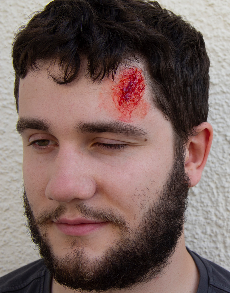 EZ WOUNDS – WUNDENSIMULATION FÜR SIMULATIONSPATIENTEN EZ WOUNDS – WUNDENSIMULATION FÜR SIMULATIONSPATIENTEN